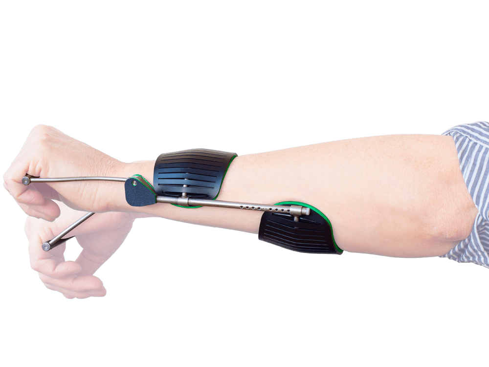 Dynamic Hand Splint