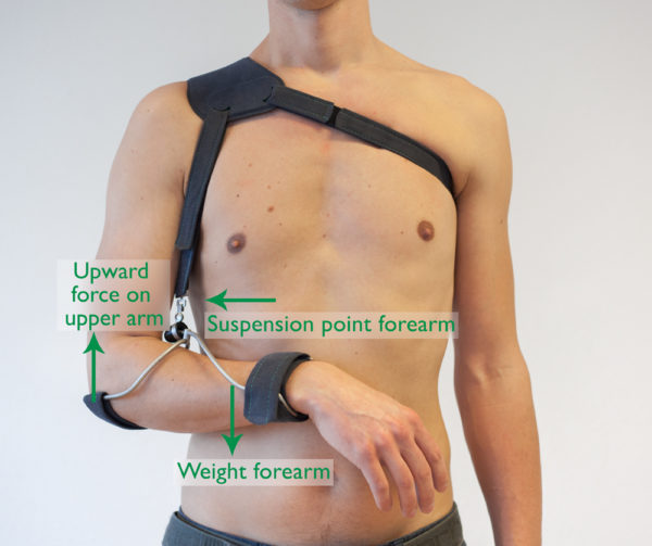 Working principle WILMER2 Carrying Orthosis