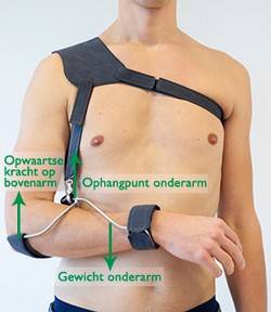 Werking van de Wilmer2 Draagorthese