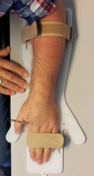 Photo measurement Static Hand Splint