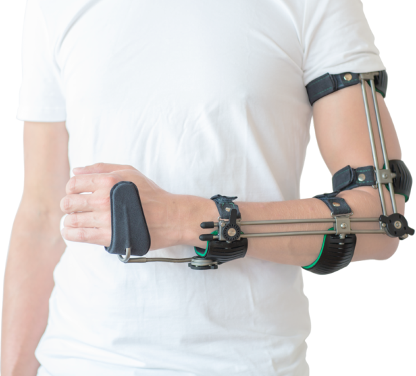 Ambroise_Triplemode_Armorthese • Ambroise