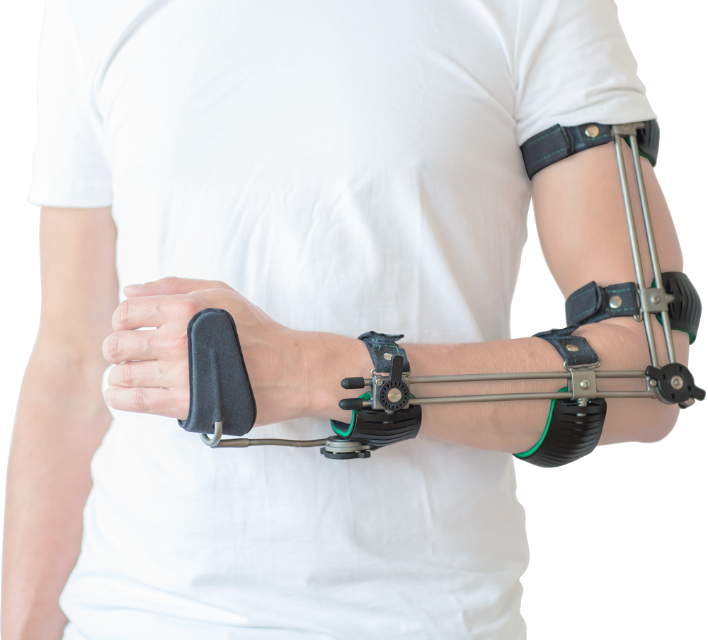 Ambroise_Triplemode_Armorthese • Ambroise