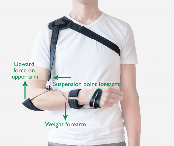 Working principle WILMER2 Carrying Orthosis