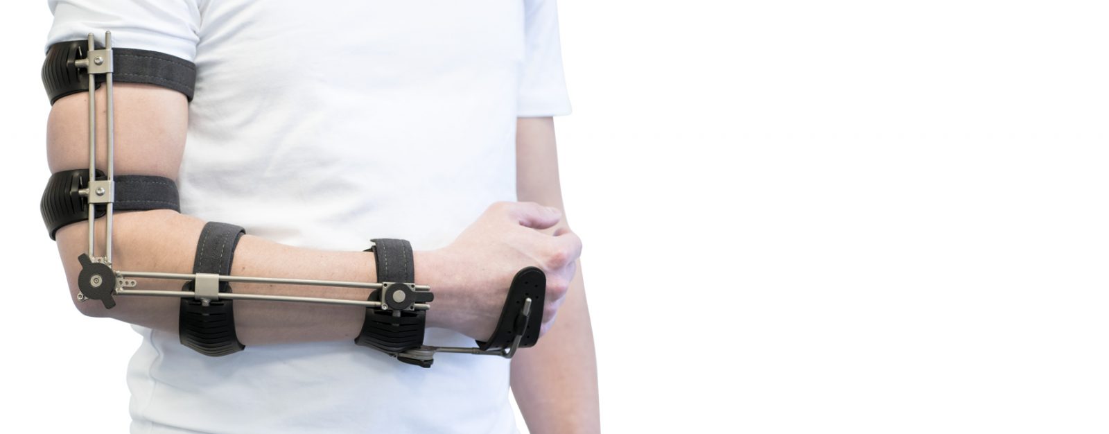 Ambroise Triple-mode Arm orthosis